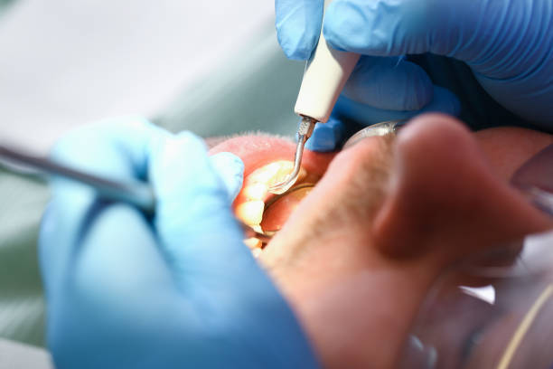 Best Cracked Tooth Emergency Dentist  in , OH